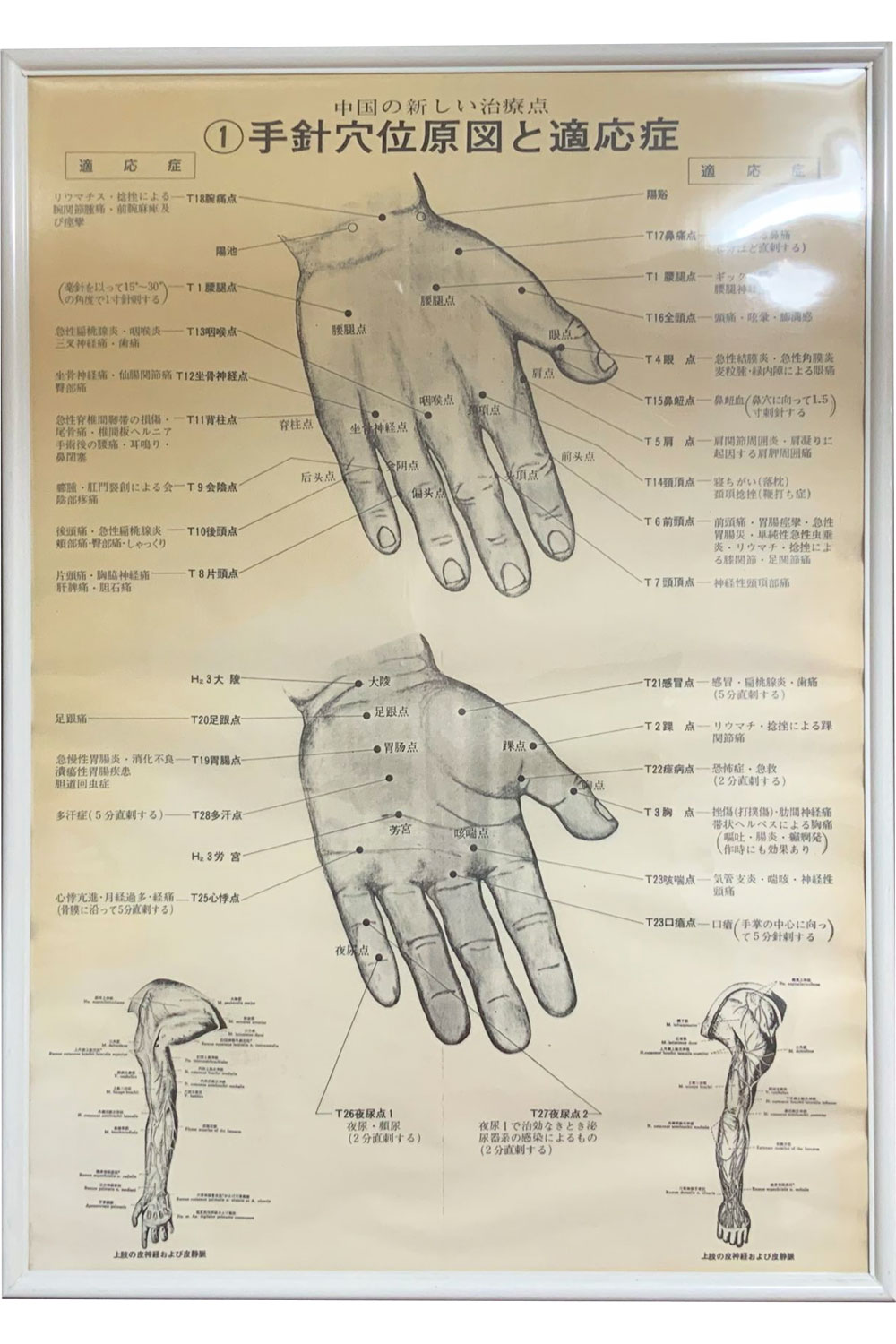手針穴位原図と適応症
